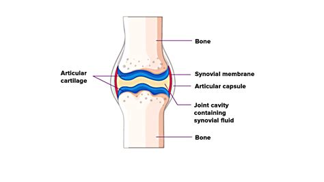 Draw a labeled diagram of a synovial joint. Give examples for a hinge ...