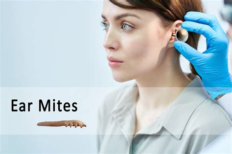 Ear Mites in Humans, Symptoms, and Treatment | Ungex