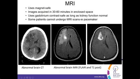 Brain Tumor Color Mri