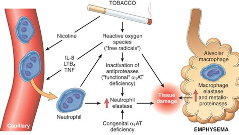 Emphysema