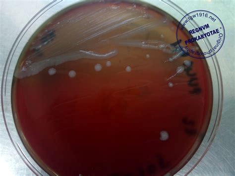 Alcaligenes Faecalis Gram Stain