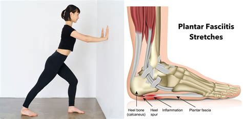 10 Best Plantar Fasciitis Exercises Stretches And Strengthening — Feet ...