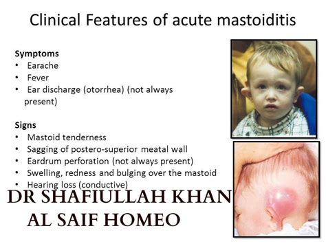 Mastoiditis Symptoms