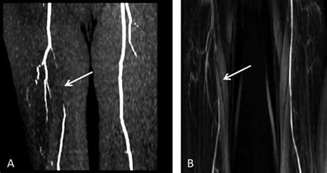 Noncontrast MR angiography (NC-MRA) and contrast-enhanced MR ...