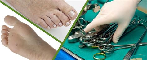 Foot and Ankle Surgery- Canberra's podiatric surgeon