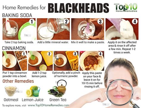 Home Remedies to Get Rid of Blackheads Fast | Top 10 Home Remedies