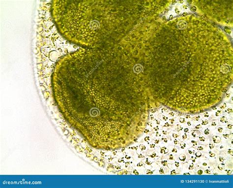 Volvox Algae Under Microscope - 400x Stock Photo - Image of brightfield ...