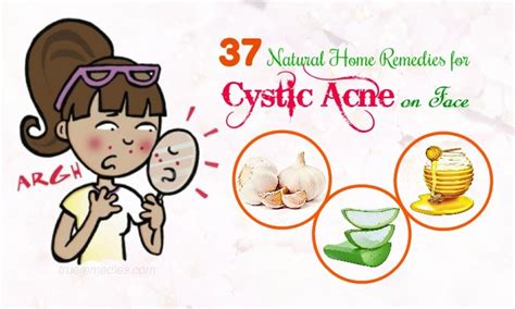 37 Natural Home Remedies For Cystic Acne On Face