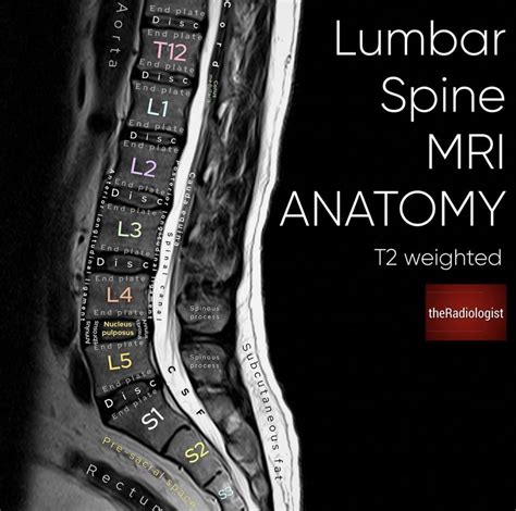 Lumbar Spine Mri Labeled