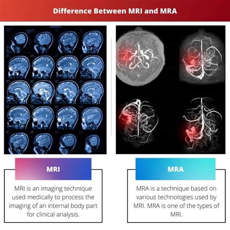 MRI vs MRA: Difference and Comparison