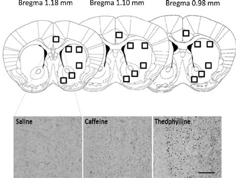 Upper part: diagram of coronal sections with bregma coordinates taken ...