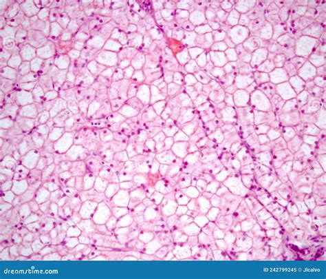 Human liver. Glycogenosis stock image. Image of biological - 242799245