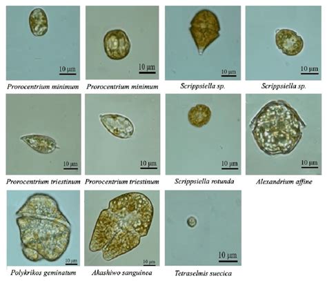 Algae Under Microscope Labeled