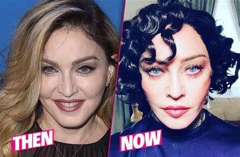 Madonna's Shocking Plastic Surgery Makeover Exposed By Top Docs