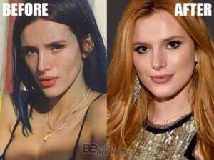 Bella Thorne Plastic Surgery Secrets! Before And After