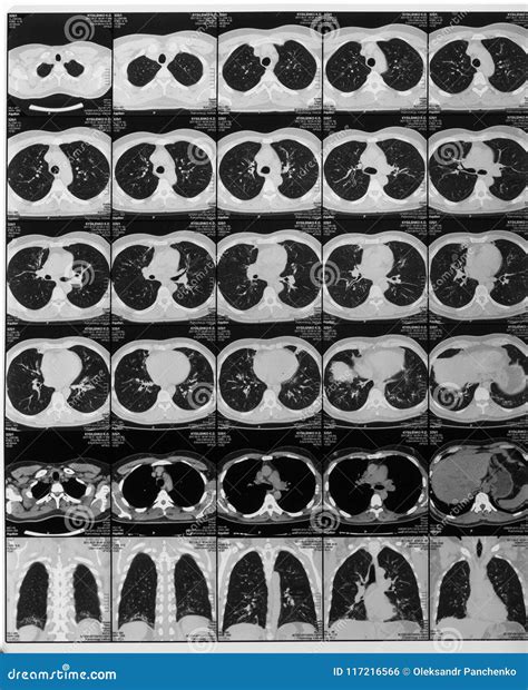 Mrt Scan Results or Radiography Shot, Medical Technology and Roe Stock ...