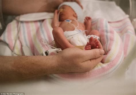 Pictures Of Premature Babies Born At 31 Weeks - Baby Viewer