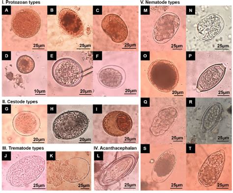 GI parasite genera types identified from fecal samples of toque ...