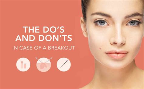 Popping Zits: A How to Guide of Do's and Don'ts When Popping a Pimple ...