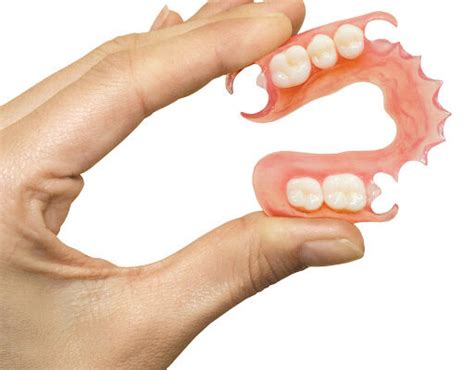 Removable Partial Denture Philippines