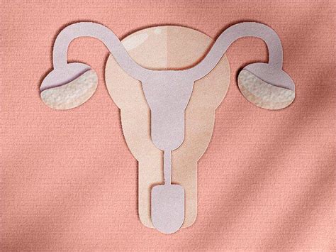 Ovarian teratoma: Symptoms, causes, and more