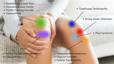 Knee Pain Location Chart | Learn the Pain Location of Knee Injuries