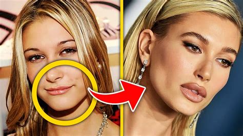 Top 10 Celebrities That Ruined Their Face With BOTCHED Lip Fillers ...