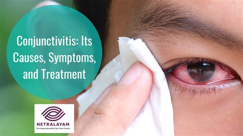 Conjunctivitis Causes Symptoms Precautions And Treatments ...