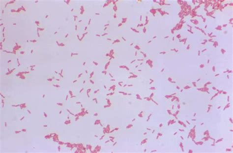 Alcaligenes Faecalis Gram Stain