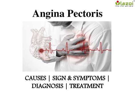 Angina pectoris : causes, symptoms, diagnosis and treatment