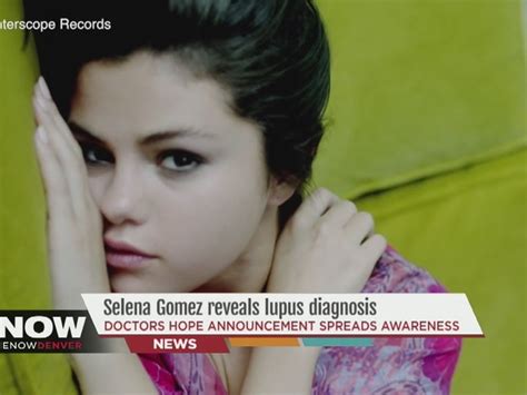 Selena Gomez reveals lupus diagnosis