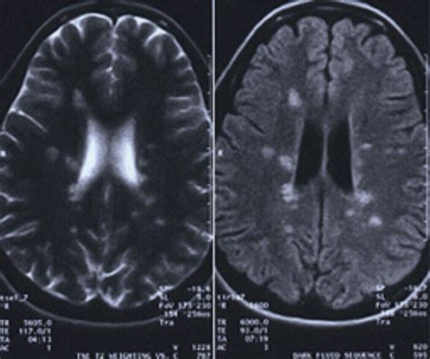 The Who and Why of MRI