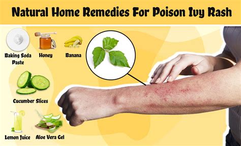 Poison Ivy Rash causes and Home Natural Home Remedies