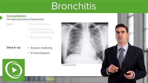 Chest X Ray Pneumonia Vs Bronchitis