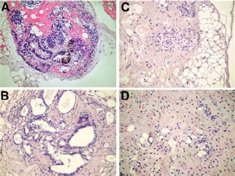 Teratoma histology. H/E staining of teratomas from undifferentiated ...