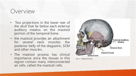 Mastoid Process