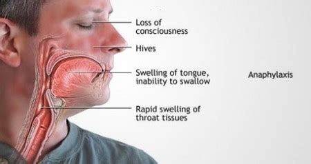 Two "breakthrough" drugs near approval combating peanut allergy.