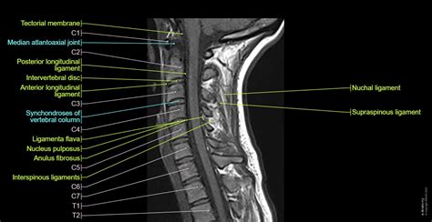 Lumbar Spine Mri Labeled