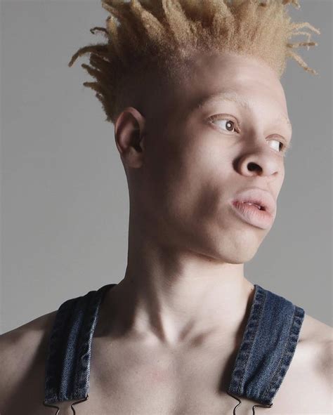 Jil_Kos | Albino men, Albino, Portrait