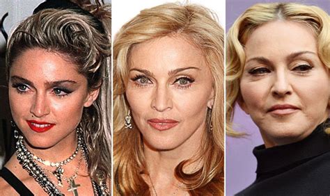 Madonna - what plastic surgeries did she had?