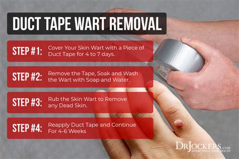 Planters Wart Removal Duct Tape | Bruin Blog