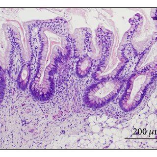 Histology of teratoma generated by Edom-iPS#S23 cells. (a) Teratoma ...