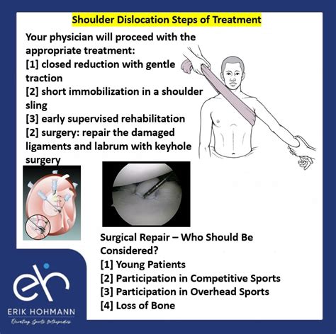 Shoulder Dislocation Steps of Treatment - Sports Injury specialist in Dubai