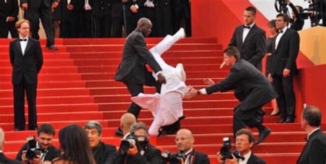 PHOTO Jason Derulo Landed On His Head After Falling Down Stairs