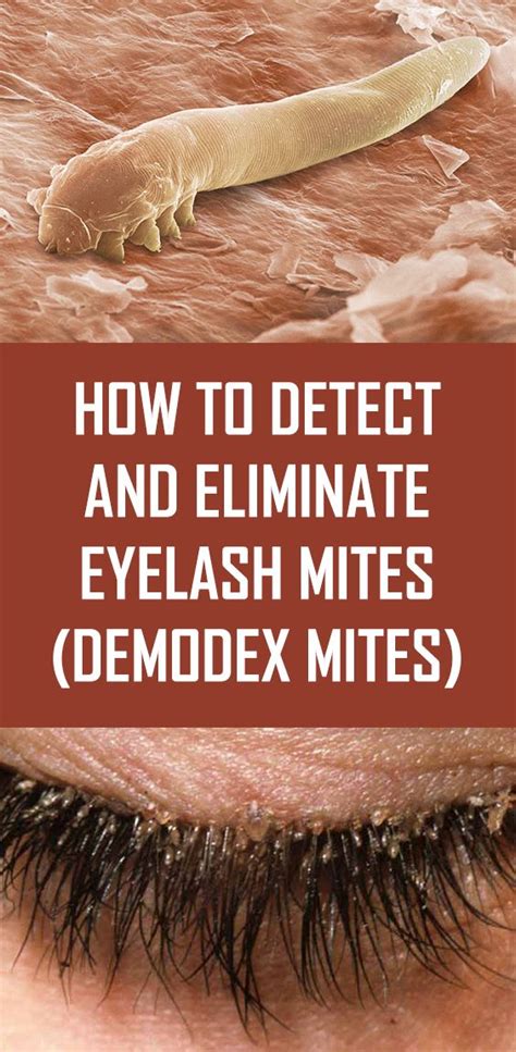 90 Amazing What Are Demodex Mites In Humans - insectza