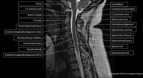 lunes cojo jazz mri spine anatomy Municipios Barcelona entregar