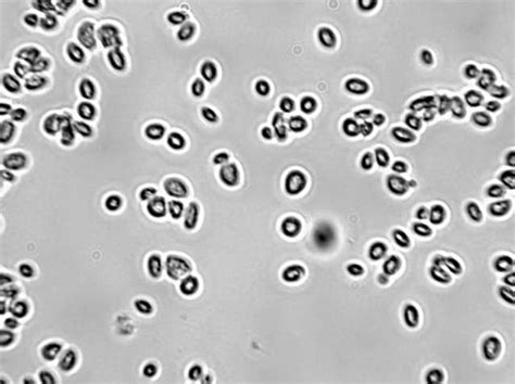 Observing Yeast Under The Microscope » Microscope Club