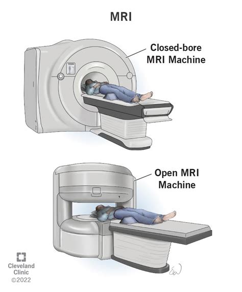 Open MRI Vs Closed MRI: What Is The Difference And Which, 47% OFF