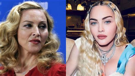 Madonna Before and After Plastic Surgery Journey: What Did She Do to ...