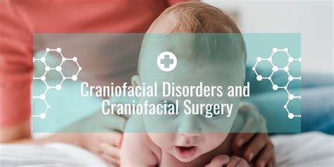 Craniofacial Disorders and Craniofacial Surgery - Dubai Clinics